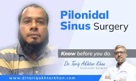 Pilonidal Sinus Surgery Feedback