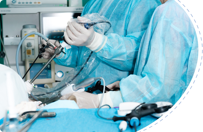 Benefits of transanal minimally invasive surgery