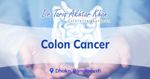 Colon Cancer treatment in Bangladesh