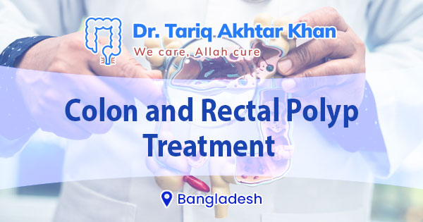 Colon and Rectal polyp treatment in Bangladesh