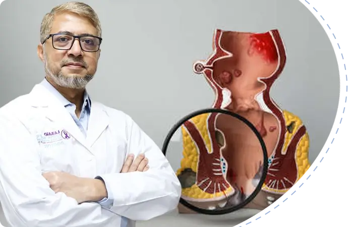 Best colorectal surgeon in Chittagong