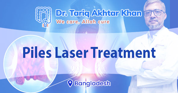 Piles laser treatment cost in Bangladesh