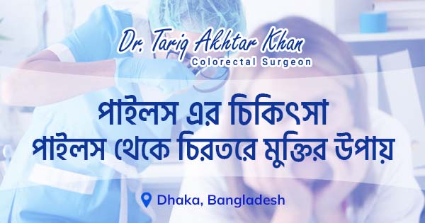 পাইলস এর চিকিৎসা; পাইলস থেকে চিরতরে মুক্তির উপায়