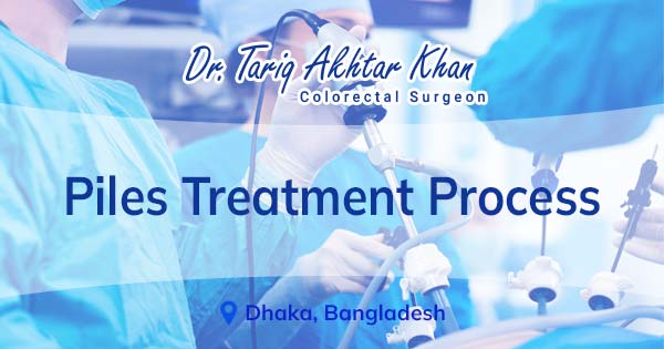 Piles treatment process | Bangladesh