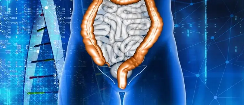 কোলন ক্যান্সারের প্রাথমিক লক্ষণ ও চিকিৎসা