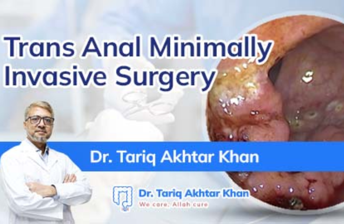 TransAnal Minimally Invasive Surgery